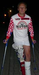 Jörg A.r.n.o.l.d after his hospital visit. Even walking on crutches, he cuts a fine figure in his Hutch clothes